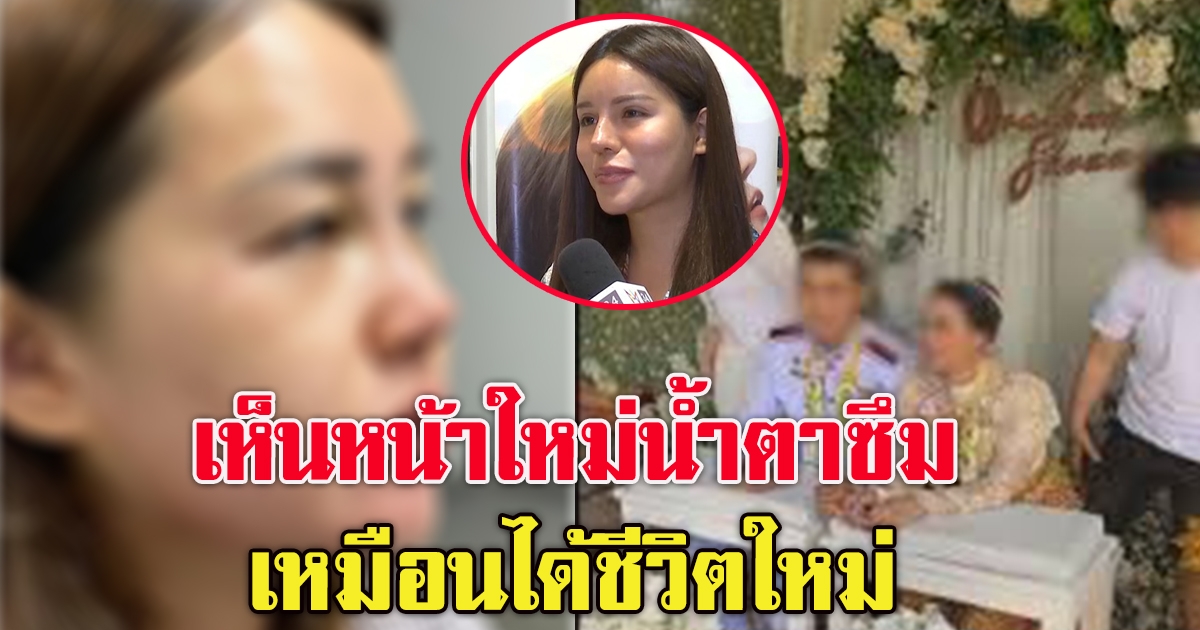 คลินิกใจป้ำทุ่มครึ่งล้านเปลี่ยนลุคเมียหลวงยืนหนึ่ง ล่าสุดทำตา ทำปากกระจับ เจ้าตัวตะลึงโฉมใหม่ไม่ง้อผัว (คลิป)