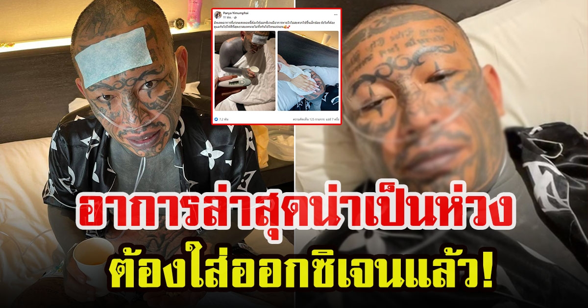 เก่ง ลายพราง เผยอาการล่าสุด