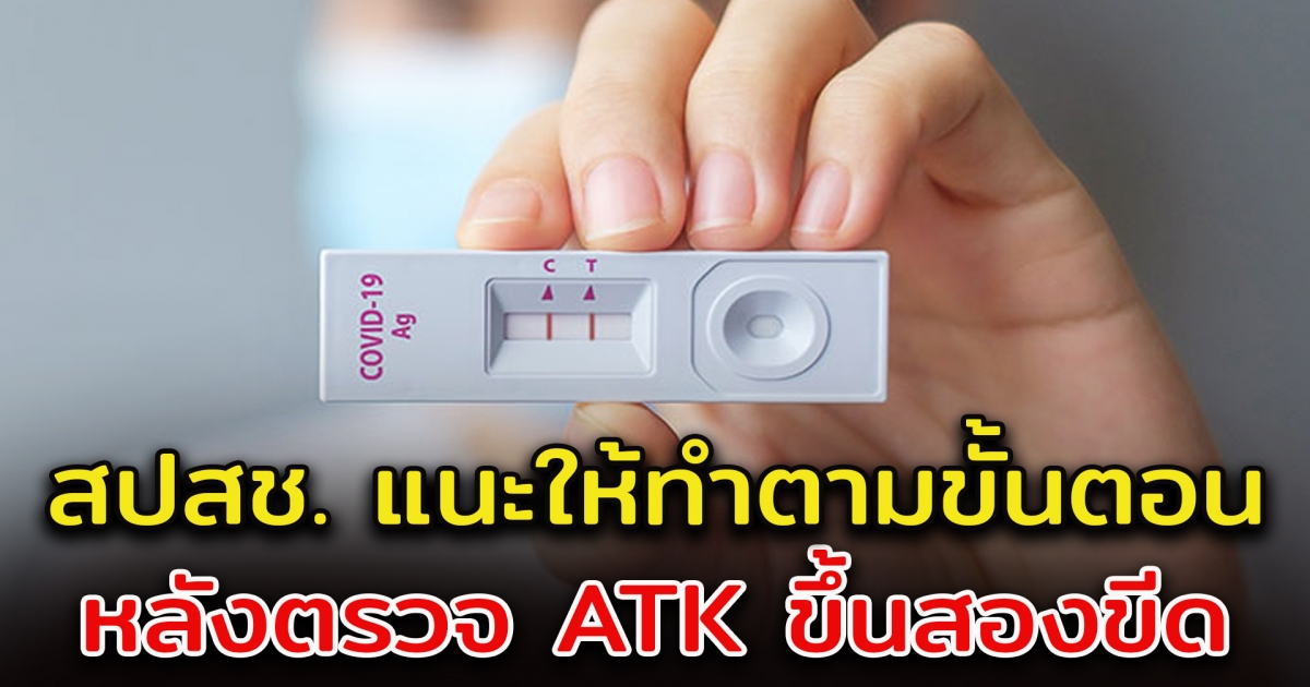 สปสช. แนะให้ทำขั้นตอน หากตรวจ ATK แล้วขึ้น 2 ขีด