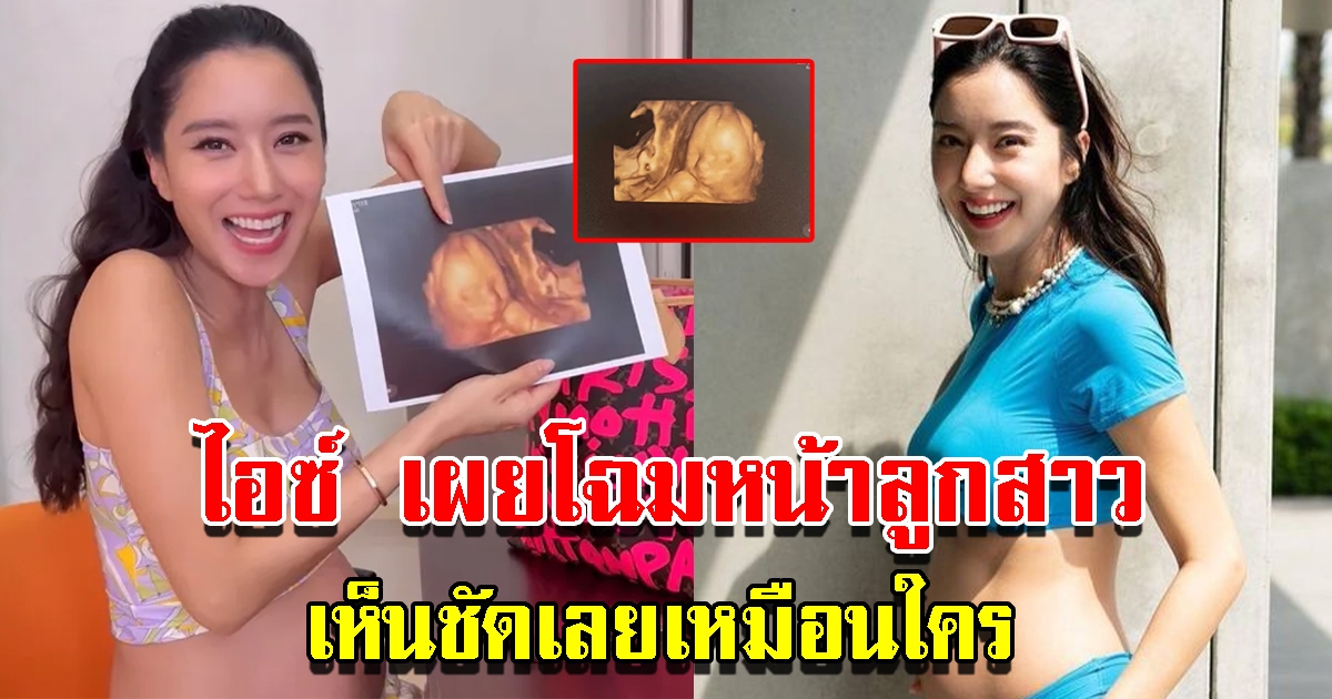 ไอซ์ อภิษฎา เผยโฉมหน้าลูกสาวคนแรก