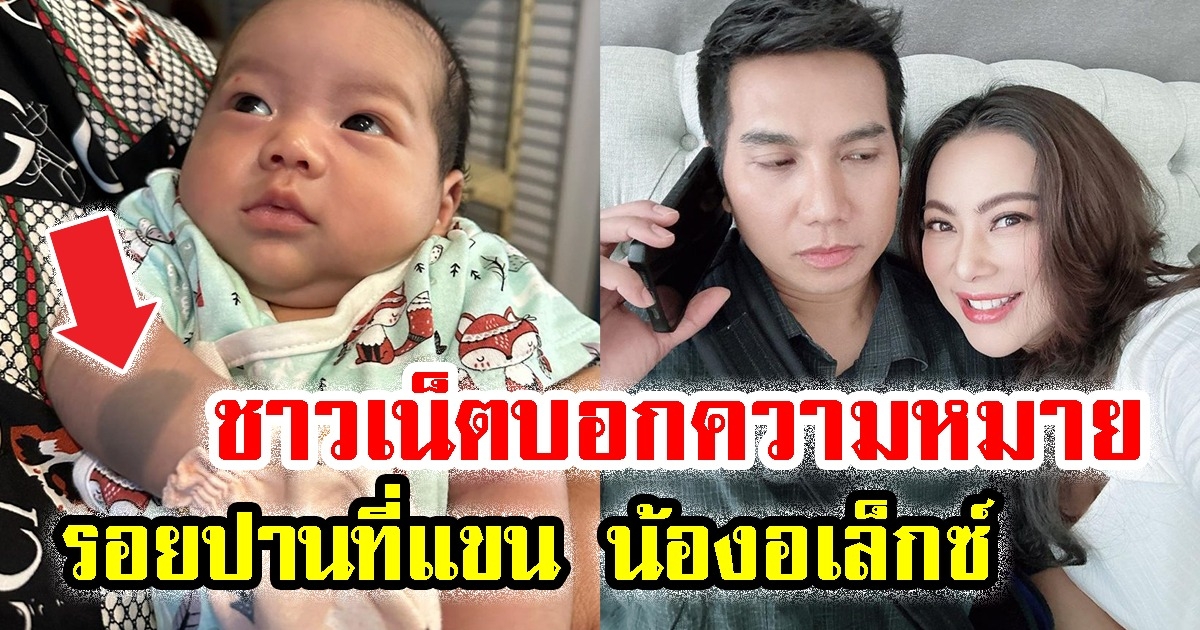 ชาวเน็ต เผยความหมาย รอยปานที่แขน น้องอเล็กซ์ ลูก บุ๋ม ปนัดดา