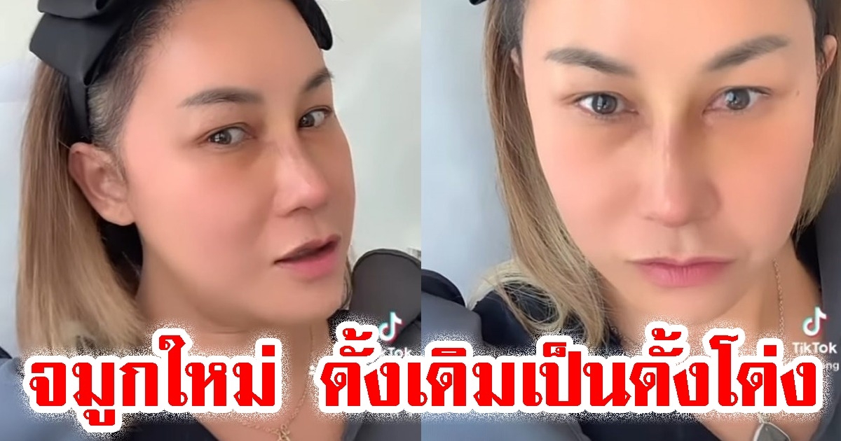 ส่องจมูกใหม่ ลูลู่ อาร์สยาม เปลี่ยนดั้งเดิมให้เป็นดั้งโด่ง เพราะเหตุผลนี้