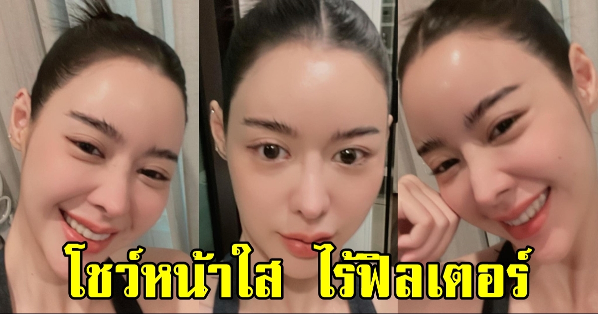 ไอซ์ ปรีชญา โชว์ภาพหน้าแบบโนฟิลเตอร์ ผิวดีเว่อร์ เริ่ดปังมาก