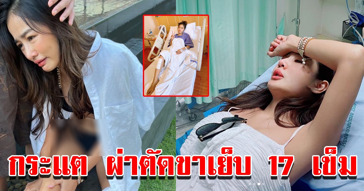 กระแต ผ่าตัดขา เย็บ17เข็ม เจ็บปวดโดนจุดสำคัญ